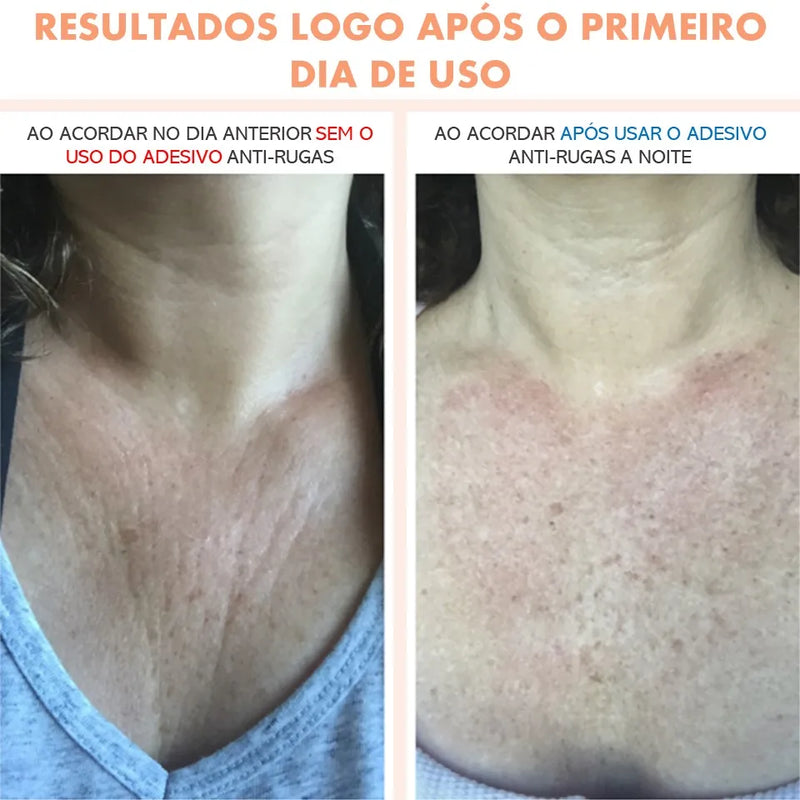 Anti Rugas Para Decote Colo Silicone Adesivo Pad Estimula Colágeno Natural para